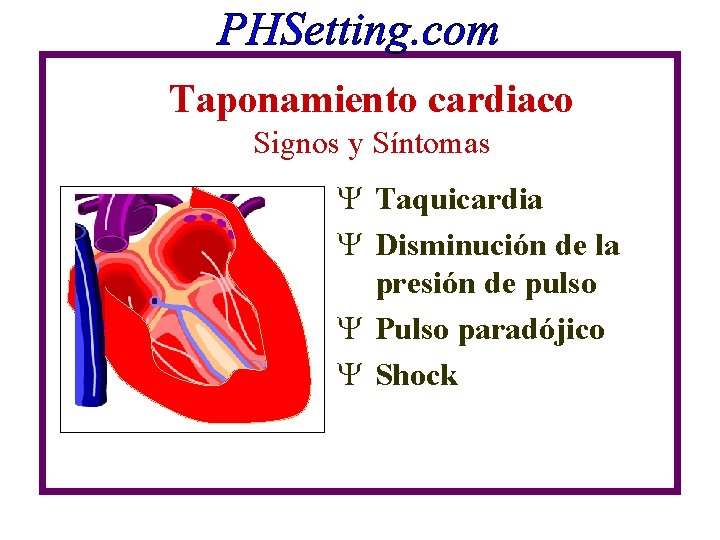 Taponamiento cardiaco Signos y Síntomas Y Taquicardia Y Disminución de la presión de pulso Taponamiento cardiaco Signos y Síntomas Y Taquicardia Y Disminución de la presión de pulso