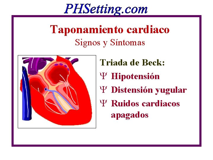 Taponamiento cardiaco Signos y Síntomas Triada de Beck: Y Hipotensión Y Distensión yugular Y Taponamiento cardiaco Signos y Síntomas Triada de Beck: Y Hipotensión Y Distensión yugular Y