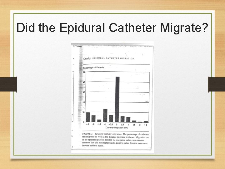 Did the Epidural Catheter Migrate? 