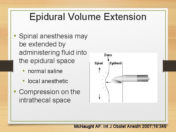 Epidural Volume Extension • Spinal anesthesia may be extended by administering fluid into the