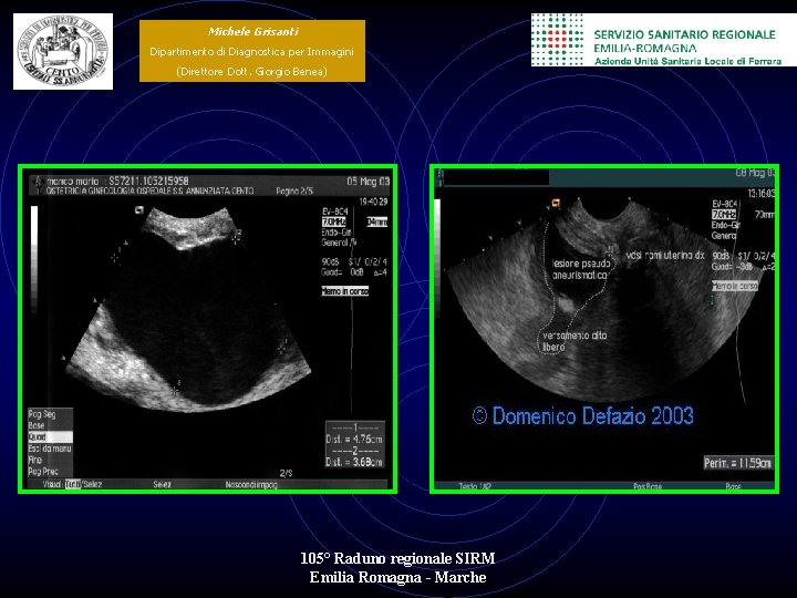 Michele Grisanti Dipartimento di Diagnostica per Immagini (Direttore Dott. Giorgio Benea) 105° Raduno regionale