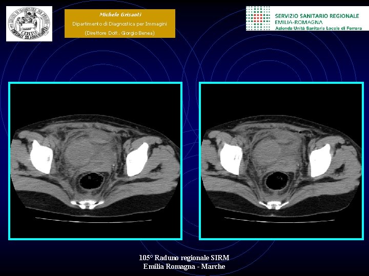 Michele Grisanti Dipartimento di Diagnostica per Immagini (Direttore Dott. Giorgio Benea) 105° Raduno regionale