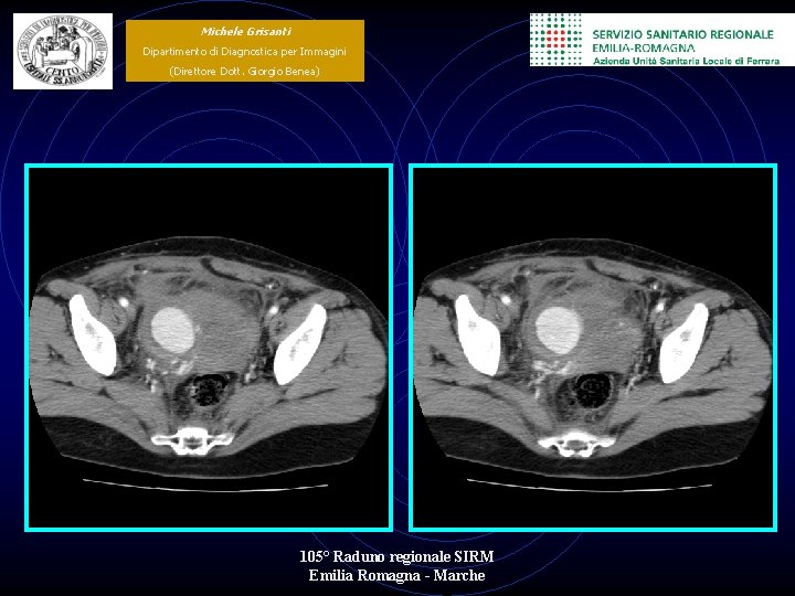 Michele Grisanti Dipartimento di Diagnostica per Immagini (Direttore Dott. Giorgio Benea) 105° Raduno regionale