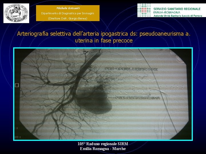 Michele Grisanti Dipartimento di Diagnostica per Immagini (Direttore Dott. Giorgio Benea) Arteriografia selettiva dell’arteria