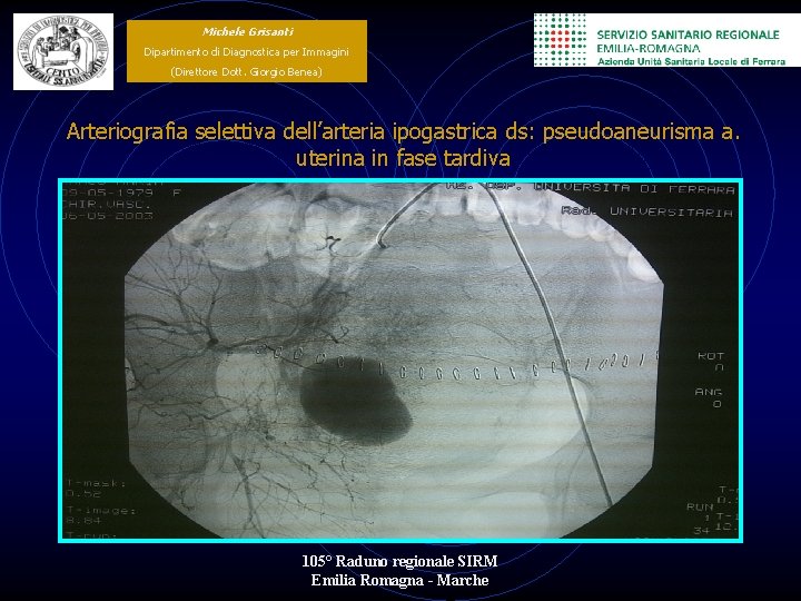 Michele Grisanti Dipartimento di Diagnostica per Immagini (Direttore Dott. Giorgio Benea) Arteriografia selettiva dell’arteria