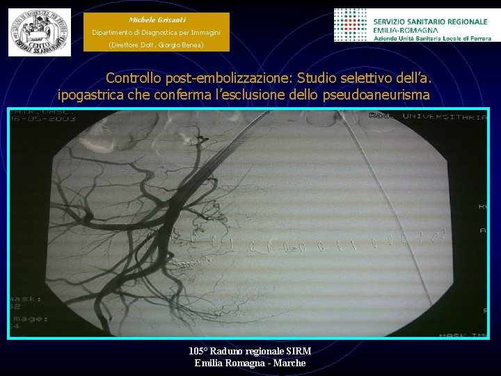 Michele Grisanti Dipartimento di Diagnostica per Immagini (Direttore Dott. Giorgio Benea) Controllo post-embolizzazione: Studio