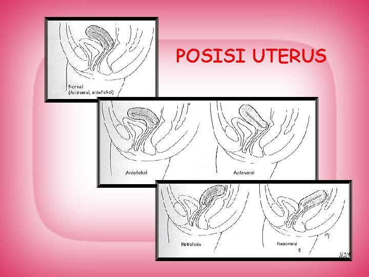 POSISI UTERUS 29 