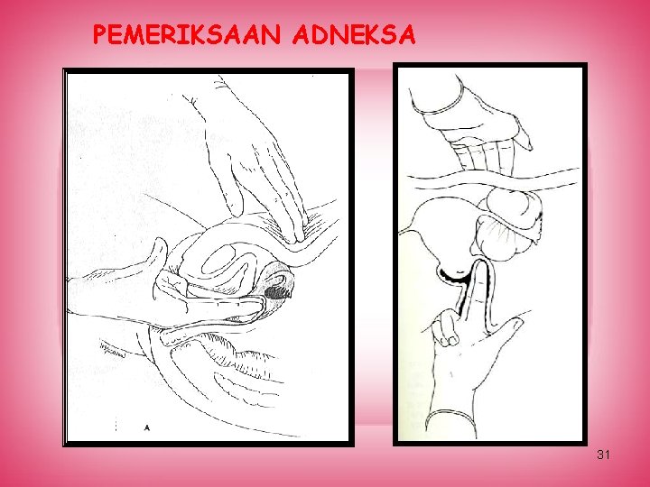PEMERIKSAAN ADNEKSA 31 