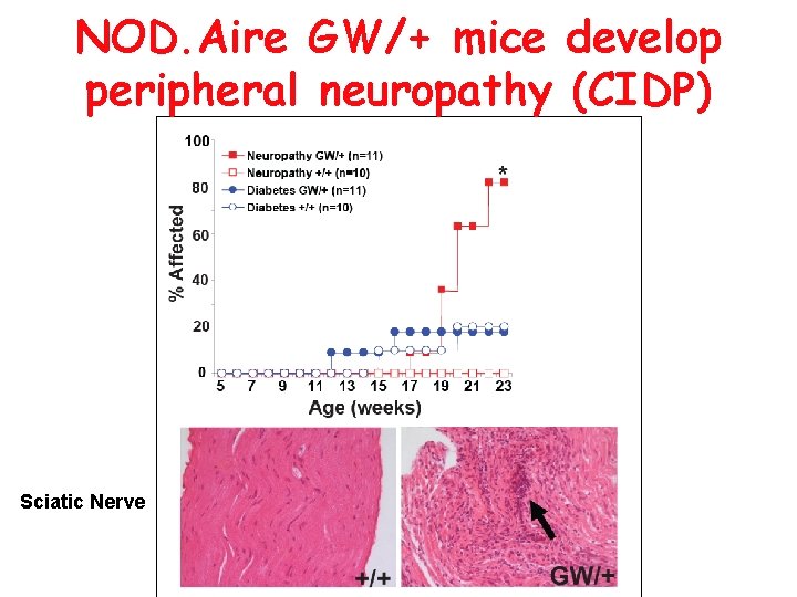 NOD. Aire GW/+ mice develop peripheral neuropathy (CIDP) Sciatic Nerve 