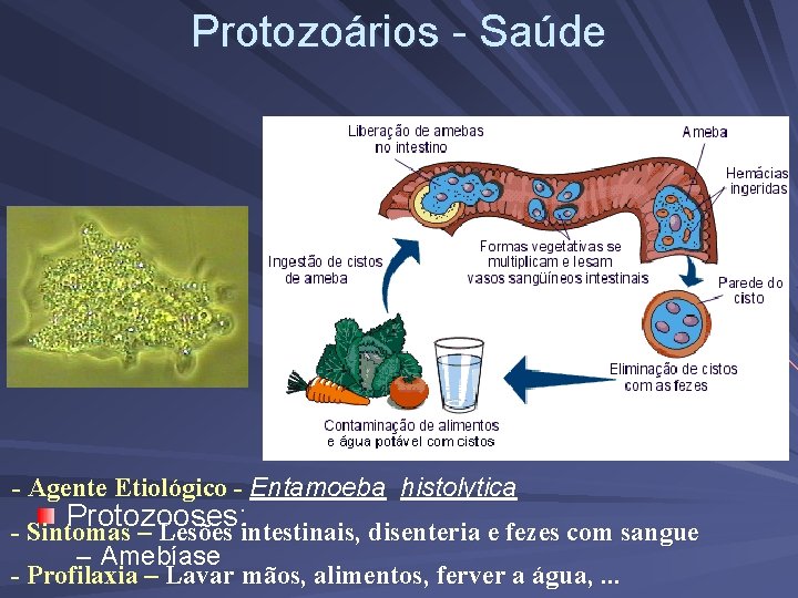 Protozoários - Saúde - Agente Etiológico - Entamoeba histolytica Protozooses: Protozooses - Sintomas –