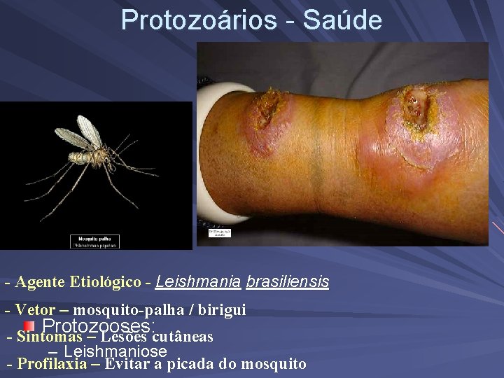 Protozoários - Saúde - Agente Etiológico - Leishmania brasiliensis - Vetor – mosquito-palha /