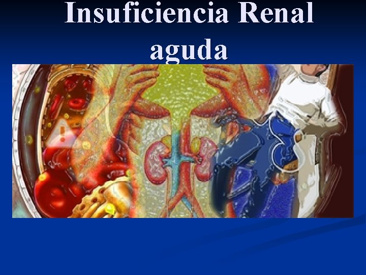 Insuficiencia Renal aguda 