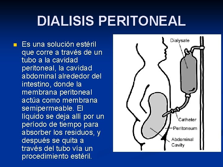 DIALISIS PERITONEAL n Es una solución estéril que corre a través de un tubo