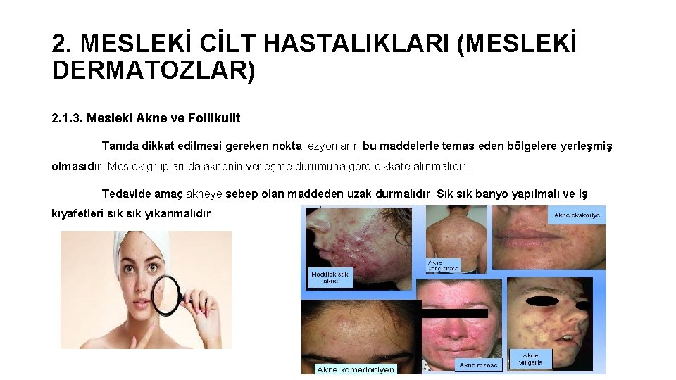 2. MESLEKİ CİLT HASTALIKLARI (MESLEKİ DERMATOZLAR) 2. 1. 3. Mesleki Akne ve Follikulit Tanıda