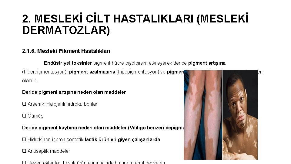 2. MESLEKİ CİLT HASTALIKLARI (MESLEKİ DERMATOZLAR) 2. 1. 6. Mesleki Pikment Hastalıkları Endüstriyel toksinler