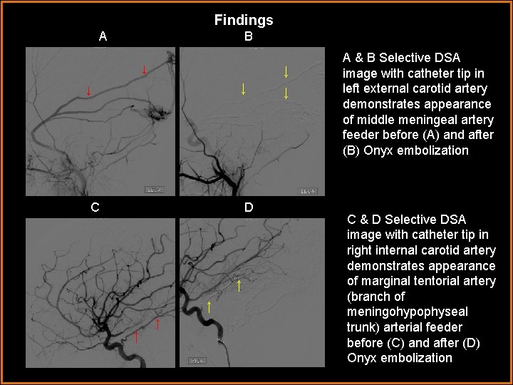 Findings A B ↓ ↓ C D A ↑↑ ↑↑ ↓ A & B