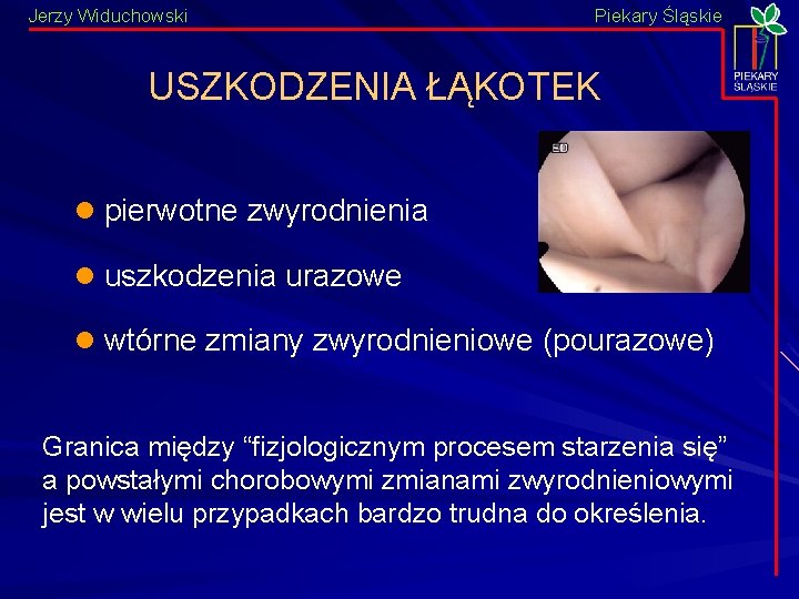 Jerzy Widuchowski Piekary Śląskie USZKODZENIA ŁĄKOTEK l pierwotne zwyrodnienia l uszkodzenia urazowe l wtórne