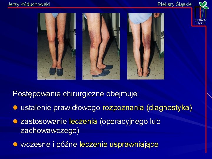 Jerzy Widuchowski Piekary Śląskie Postępowanie chirurgiczne obejmuje: l ustalenie prawidłowego rozpoznania (diagnostyka) l zastosowanie