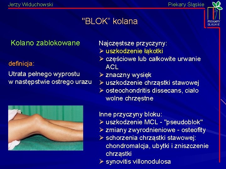 Jerzy Widuchowski Piekary Śląskie "BLOK” kolana Kolano zablokowane definicja: Utrata pełnego wyprostu w następstwie