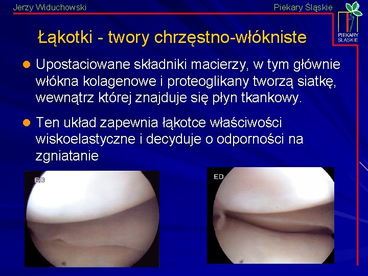 Jerzy Widuchowski Piekary Śląskie Łąkotki - twory chrzęstno-włókniste l Upostaciowane składniki macierzy, w tym