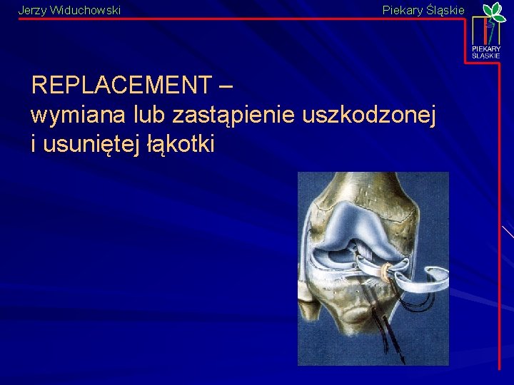 Jerzy Widuchowski Piekary Śląskie REPLACEMENT – wymiana lub zastąpienie uszkodzonej i usuniętej łąkotki 