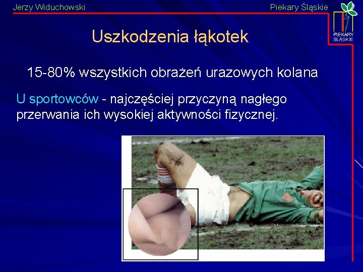 Jerzy Widuchowski Piekary Śląskie Uszkodzenia łąkotek 15 -80% wszystkich obrażeń urazowych kolana U sportowców