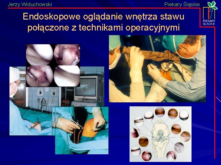 Jerzy Widuchowski Piekary Śląskie Endoskopowe oglądanie wnętrza stawu połączone z technikami operacyjnymi 