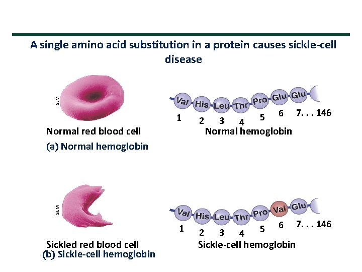 SEM A single amino acid substitution in a protein causes sickle-cell disease 1 3