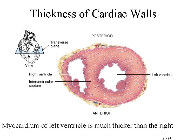 Thickness of Cardiac Walls Myocardium of left ventricle is much thicker than the right. Thickness of Cardiac Walls Myocardium of left ventricle is much thicker than the right.