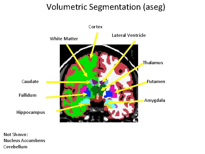 Volumetric Segmentation (aseg) Cortex White Matter Lateral Ventricle Thalamus Caudate Pallidum Hippocampus Not Shown: