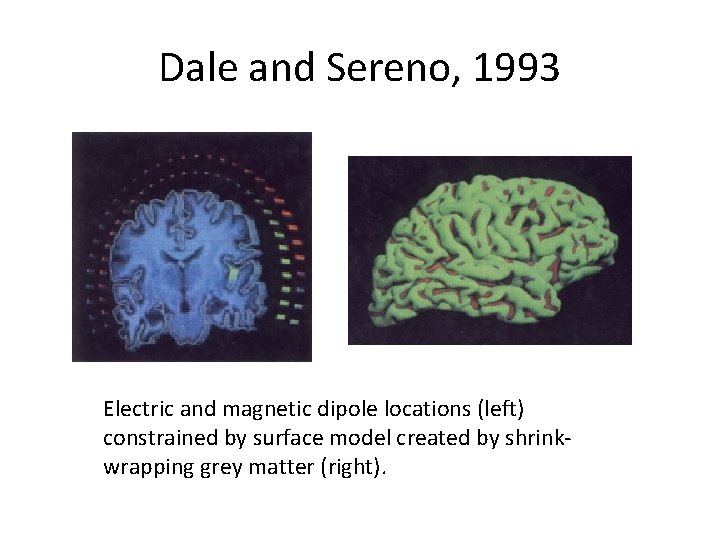 Dale and Sereno, 1993 Electric and magnetic dipole locations (left) constrained by surface model