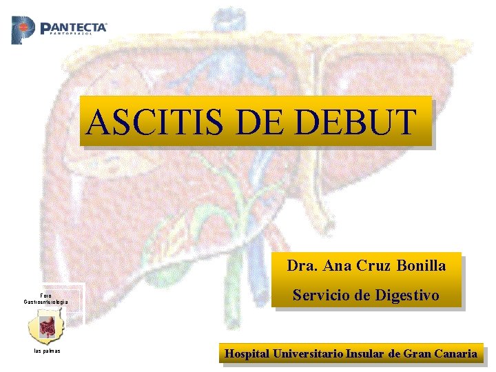 ASCITIS DE DEBUT Dra. Ana Cruz Bonilla Foro Gastroenterología las palmas Servicio de Digestivo