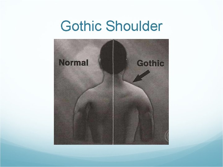 Gothic Shoulder 