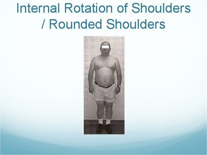 Internal Rotation of Shoulders / Rounded Shoulders 