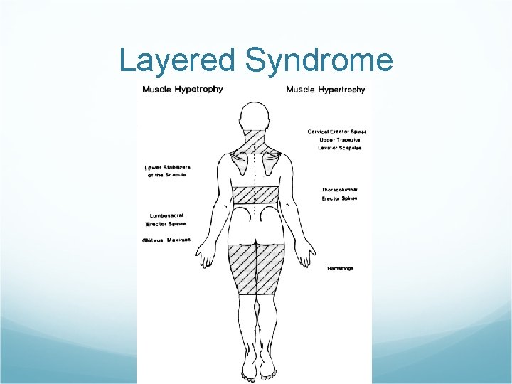 Layered Syndrome 