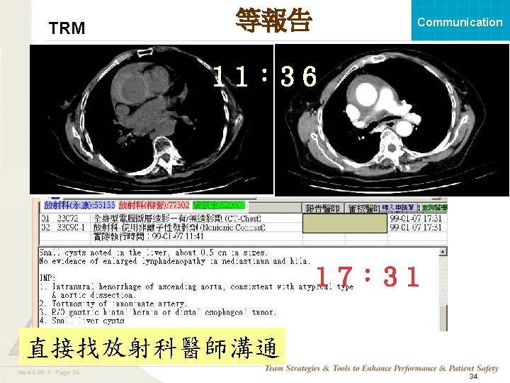 TRM 等報告 Communication １１：３６ １７：３１ 直接找放射科醫師溝通 Mod 6 06. 1 Page 34 TEAMSTEPPS 05.