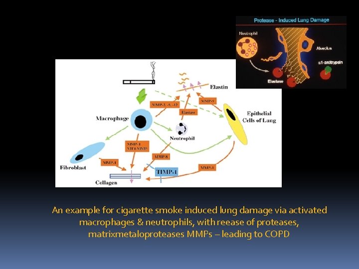 An example for cigarette smoke induced lung damage via activated macrophages & neutrophils, with