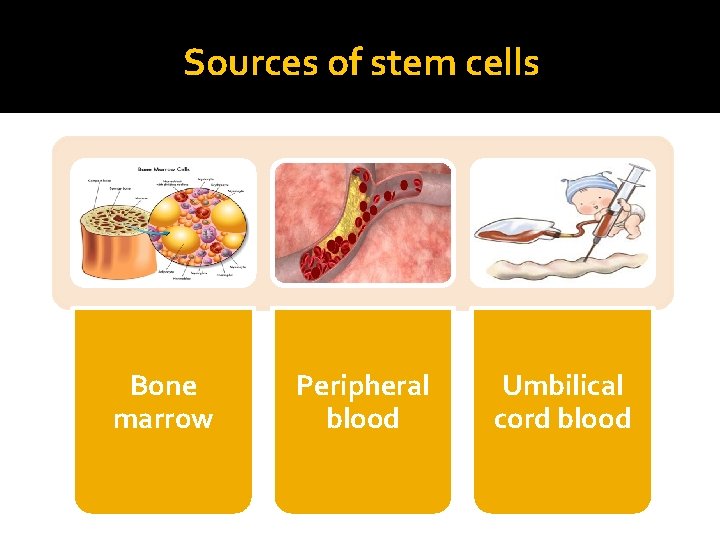 Sources of stem cells Bone marrow Peripheral blood Umbilical cord blood 