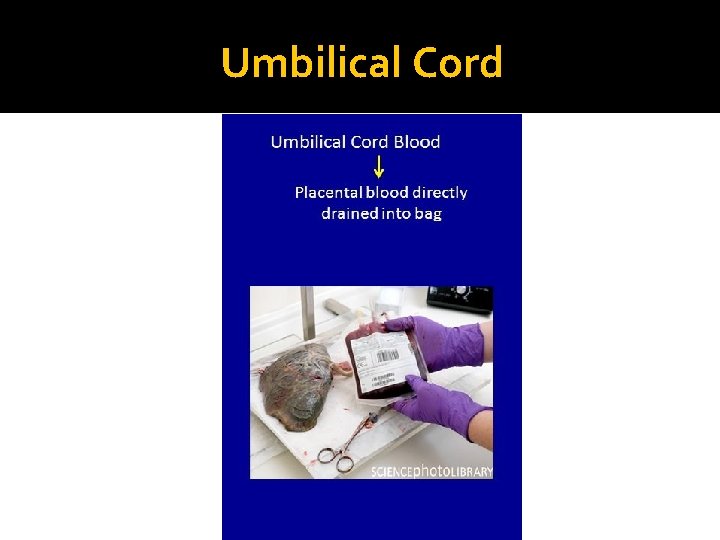 Umbilical Cord 