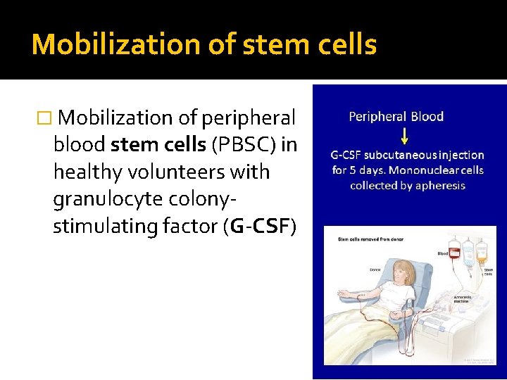 Mobilization of stem cells � Mobilization of peripheral blood stem cells (PBSC) in healthy