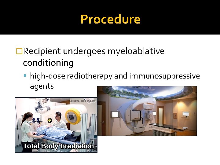 Procedure �Recipient undergoes myeloablative conditioning high-dose radiotherapy and immunosuppressive agents 