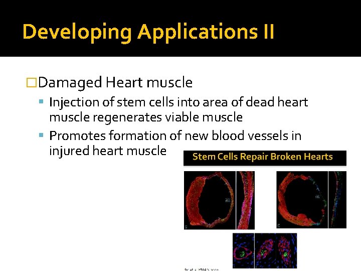 Developing Applications II �Damaged Heart muscle Injection of stem cells into area of dead