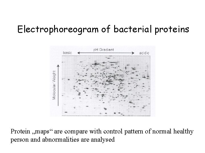 Electrophoreogram of bacterial proteins Protein „maps“ are compare with control pattern of normal healthy