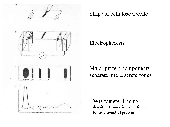 Stripe of cellulose acetate Electrophoresis Major protein components separate into discrete zones Densitometer tracing