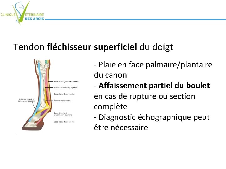 Tendon fléchisseur superficiel du doigt - Plaie en face palmaire/plantaire du canon - Affaissement Tendon fléchisseur superficiel du doigt - Plaie en face palmaire/plantaire du canon - Affaissement