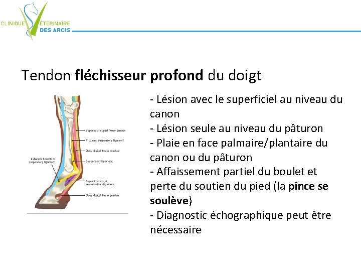 Tendon fléchisseur profond du doigt - Lésion avec le superficiel au niveau du canon Tendon fléchisseur profond du doigt - Lésion avec le superficiel au niveau du canon