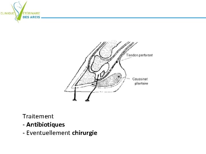 Traitement - Antibiotiques - Eventuellement chirurgie Traitement - Antibiotiques - Eventuellement chirurgie