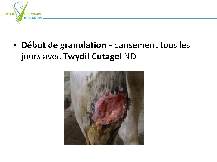 • Début de granulation - pansement tous les jours avec Twydil Cutagel ND • Début de granulation - pansement tous les jours avec Twydil Cutagel ND
