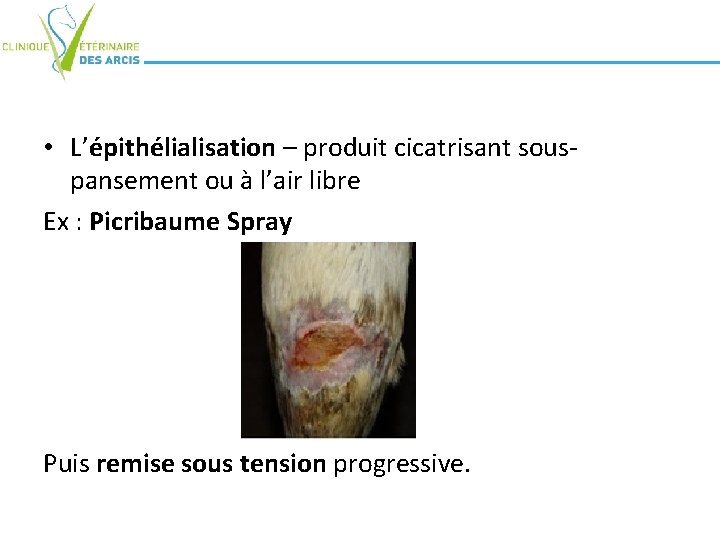 • L’épithélialisation – produit cicatrisant souspansement ou à l’air libre Ex : Picribaume • L’épithélialisation – produit cicatrisant souspansement ou à l’air libre Ex : Picribaume