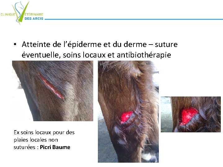 • Atteinte de l’épiderme et du derme – suture éventuelle, soins locaux et • Atteinte de l’épiderme et du derme – suture éventuelle, soins locaux et